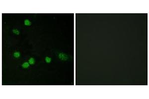 Immunofluorescence analysis of HeLa cells, using Raf1 (epitope around residue 621) antibody. (RAF1 抗体  (Ser621))
