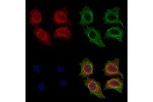 ABIN7094463 and ABIN7098511 staining HepG2 cells by IF/ICC. (FCER1G 抗体  (C-Term))