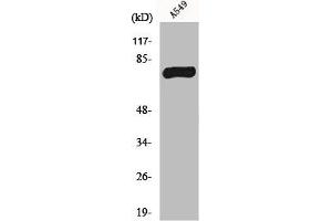 Western Blot analysis of A549 cells using MPP9 Polyclonal Antibody (MPHOSPH9 抗体  (C-Term))