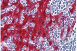 Immunohistochemistry (Formalin-fixed Paraffin-embedded Sections) (IHC (fp)) image for anti-Stratifin (SFN) (AA 1-249) antibody (ABIN574259)