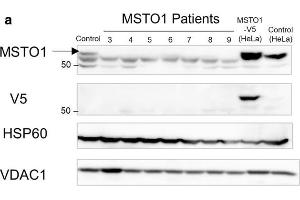 Pathogenic variants lead to MSTO1 protein instability. (MSTO1 抗体  (Center))