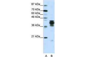 Western Blotting (WB) image for anti-Heterogeneous Nuclear Ribonucleoprotein D (HNRNPD) antibody (ABIN2462064) (HNRNPD/AUF1 抗体)