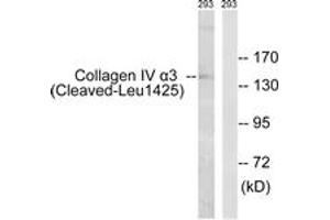 Western Blotting (WB) image for anti-Collagen, Type IV, alpha 3 (COL4A3) (AA 1376-1425), (Cleaved-Leu1425) antibody (ABIN2891188) (COL4a3 抗体  (Cleaved-Leu1425))