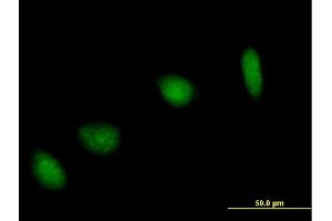 Immunofluorescence of purified MaxPab antibody to UBE2V1 on HeLa cell. (UBE2V1 抗体  (AA 1-147))