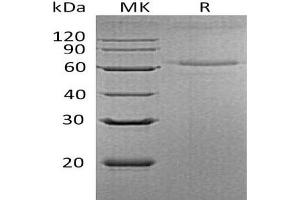 Western Blotting (WB) image for Interleukin 27 (IL27) protein (His tag) (ABIN7320591) (IL-27 Protein (His tag))