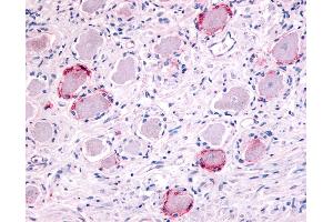 Anti-TRPA1 antibody IHC of human ganglion cells. (TRPA1 抗体  (Internal Region))