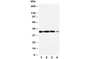 Western Blotting (WB) image for anti-Arginase, Type II (ARG2) (N-Term) antibody (ABIN3030019)