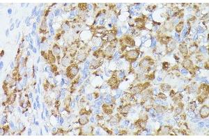 Immunohistochemistry of paraffin-embedded Rat ovary using ACAT2 Polyclonal Antibody at dilution of 1:100 (40x lens).