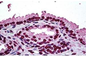 Human Prostate: Formalin-Fixed, Paraffin-Embedded (FFPE) (DLX2 抗体  (AA 1-110))