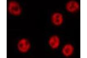 ABIN6275721 staining HepG2 by IF/ICC. (Raly 抗体  (Internal Region))