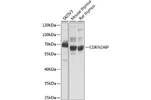 Western blot analysis of extracts of various cell lines, using CDKN2AIP antibody (ABIN1679162, ABIN3017622, ABIN3017623 and ABIN6220167) at 1:1000 dilution. (CDKN2AIP 抗体  (AA 1-220))