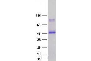 Western Blotting (WB) image for C-Type Lectin Domain Family 4, Member M (CLEC4M) (Transcript Variant 2) protein (Myc-DYKDDDDK Tag) (ABIN2716811)