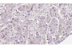 Immunohistochemistry (IHC) image for anti-Olfactory Receptor, Family 2, Subfamily A, Member 12 (OR2A12) (C-Term) antibody (ABIN6259526)