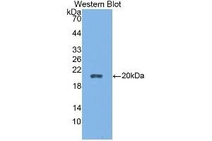 Detection of Recombinant CALY, Rat using Polyclonal Antibody to Calcyon Neuron Specific Vesicular Protein (CALY) (CALY 抗体  (AA 110-226))