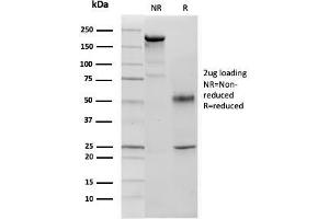 SDS-PAGE Analysis p57 Mouse Monoclonal Antibody (KIP2/880). (CDKN1C 抗体)