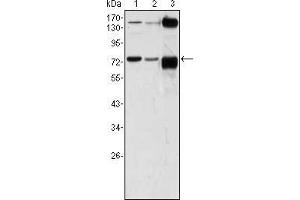 Western Blotting (WB) image for anti-ATPase, Ca++ Transporting, Type 2C, Member 1 (ATP2C1) antibody (ABIN1724719)
