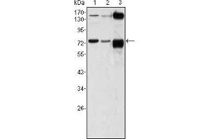 Western blot analysis using ATP2C1 mouse mAb against A431 (1), Hela (2) and HEK293 (3) cell lysate. (ATP2C1 抗体)