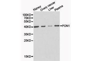Western Blotting (WB) image for anti-Paraoxonase 1 (PON1) antibody (ABIN1874193) (PON1 抗体)