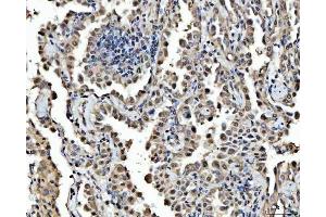 IHC analysis of FIP1L1 using anti-FIP1L1 antibody (ABIN7600761). (FIP1L1 抗体  (AA 23-558))