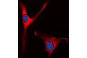 Immunofluorescent analysis of OAT staining in Raw264. (OAT 抗体  (Center))