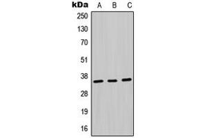 Western blot analysis of MDH1 expression in Jurkat (A), HepG2 (B), PC12 (C) whole cell lysates.