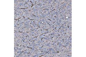 IHC analysis of PTRF/CAVIN1 using anti-PTRF/CAVIN1 antibody (ABIN7601817). (PTRF 抗体  (AA 47-390))