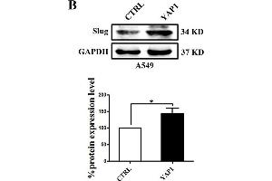 Slug is regulated by the co-transcriptional complex YAP1/TEAD in the EMT program of A549 cells. (GAPDH 抗体)