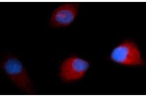 Immunofluorescence (IF) image for anti-Colony Stimulating Factor 1 (Macrophage) (CSF1) (AA 33-190) antibody (PE) (ABIN5568661) (M-CSF/CSF1 抗体  (AA 33-190) (PE))