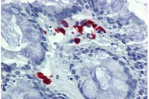 Human Colon: Formalin-Fixed, Paraffin-Embedded (FFPE) (FASL 抗体  (AA 82-145))