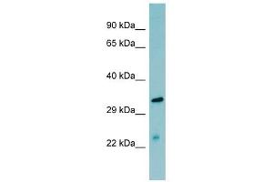 MASP2 antibody used at 1 ug/ml to detect target protein. (MASP2 抗体  (N-Term))