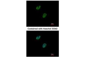 ICC/IF Image Immunofluorescence analysis of paraformaldehyde-fixed HeLa, using GABPB1, antibody at 1:500 dilution. (GABPB1 抗体  (Center))