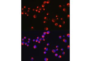 Immunofluorescence analysis of Neuro-2a cells using PRPH Rabbit pAb (ABIN1682318, ABIN3018463, ABIN3018464 and ABIN6220472) at dilution of 1:25 (40x lens). (Peripherin 抗体  (AA 1-260))