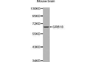Western Blotting (WB) image for anti-Growth Factor Receptor-Bound Protein 10 (GRB10) (AA 1-100) antibody (ABIN5663731) (GRB10 抗体  (AA 1-100))