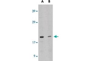 Western blot analysis of IL21 expression in HL-60 cell lysate in the absence (lane A) or presence of blocking peptide (lane B) with IL21 polyclonal antibody  at 1 ug /mL .