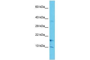 Host: Rabbit Target Name: COA1 Sample Type: Jurkat Whole Cell lysates Antibody Dilution: 1. (UBXN11 抗体  (C-Term))