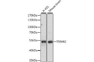 Western blot analysis of extracts of various cell lines using TRIM62 Polyclonal Antibody at dilution of 1:1000. (TRIM62 抗体)