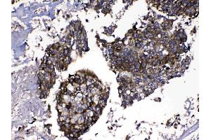 IHC analysis of MMP16 using anti-MMP16 antibody . (MMP16 抗体  (AA 120-296))