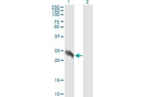Western Blot analysis of EIF5A2 expression in transfected 293T cell line by EIF5A2 monoclonal antibody (M01), clone 1E7. (EIF5A2 抗体  (AA 66-153))