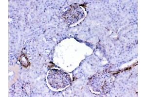 IHC testing of FFPE rat kidney tissue with Galectin 1 antibody at 1ug/ml. (LGALS1/Galectin 1 抗体)