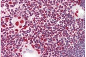 Anti-HnRNP K antibody IHC staining of human thymus. (HNRNPK 抗体  (AA 200-250))