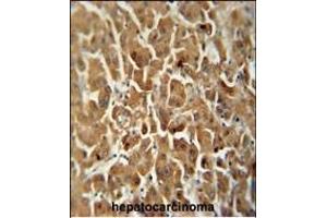Immunohistochemistry (Paraffin-embedded Sections) (IHC (p)) image for anti-ATP Synthase, H+ Transporting, Mitochondrial Fo Complex, Subunit C2 (Subunit 9) (ATP5G2) (AA 85-114), (C-Term) antibody (ABIN652087)