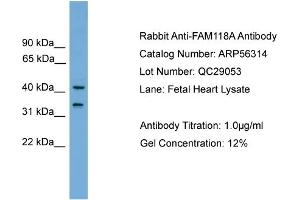 WB Suggested Anti-FAM118A  Antibody Titration: 0. (FAM118A 抗体  (Middle Region))