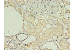 Immunohistochemistry of paraffin-embedded human kidney tissue using ABIN7155120 at dilution of 1:100 (HNRNPL 抗体  (AA 89-335))