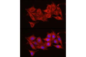 Immunofluorescence analysis of NIH/3T3 cells using  Rabbit pAb (ABIN6131155, ABIN6136539, ABIN6136540 and ABIN6221035) at dilution of 1:50 (40x lens). (ADAM9 抗体  (AA 475-685))