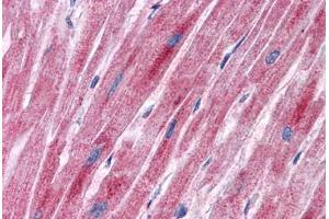 Human Heart: Formalin-Fixed, Paraffin-Embedded (FFPE) (PDK2 抗体  (AA 251-300))