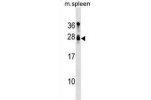 Western Blotting (WB) image for anti-Tumor Suppressor Candidate 1 (TUSC1) antibody (ABIN3000856)