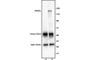 ATAD2 antibody (pAb) tested by Immunoprecipitation. (ATAD2 抗体  (C-Term))