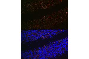 Immunofluorescence (IF) image for anti-Solute Carrier Family 17 (Vesicular Glutamate Transporter), Member 6 (SLC17A6) (C-Term) antibody (ABIN7270407)