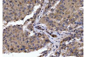 IHC analysis of GOLGA3 using anti-GOLGA3 antibody (ABIN7600298).