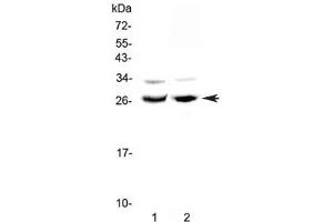 Western blot testing of 1) rat testis and 2) mouse ovary lysate with MAD antibody at 0. (MXD1 抗体)